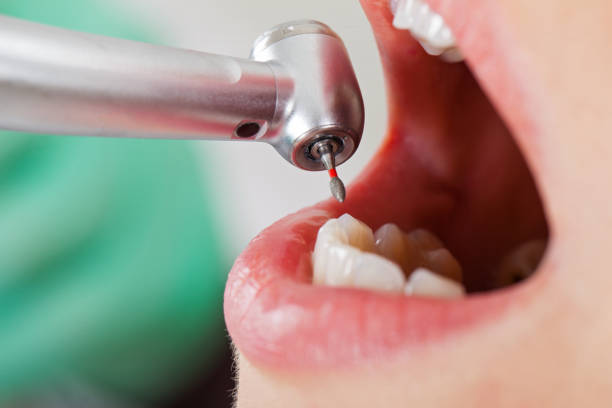 Best Root Canal Emergency Dentist  in Midwest City, OK